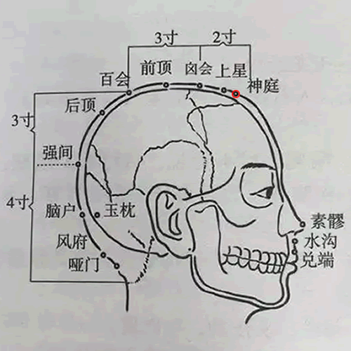 神庭
