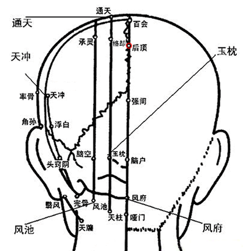 后顶