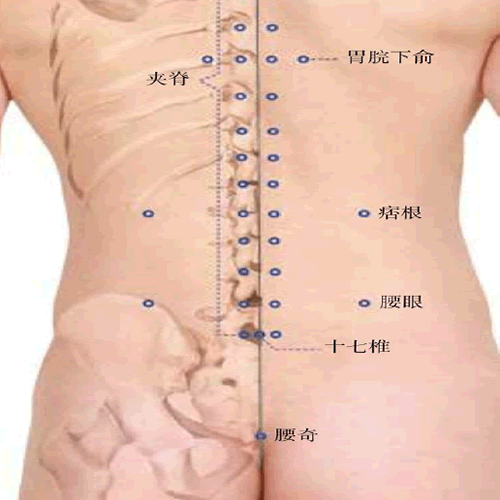 腰奇