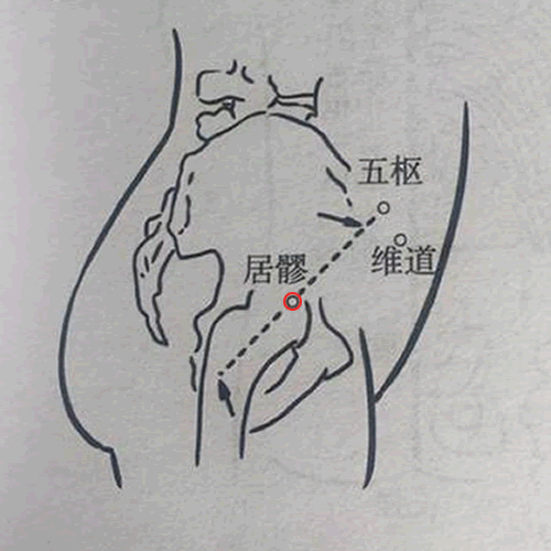 居髎