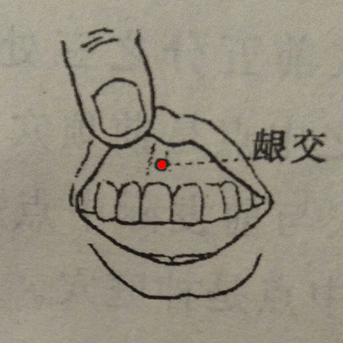 龈交