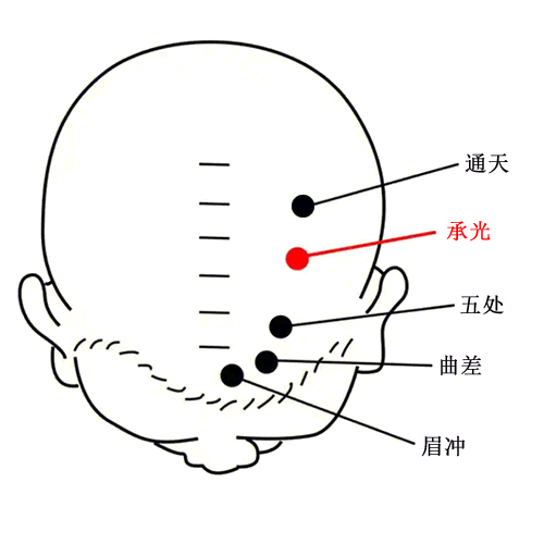 承光