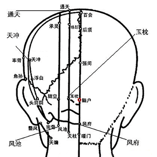 脑户
