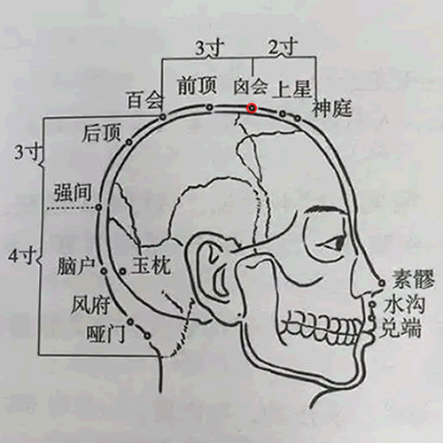 囟会