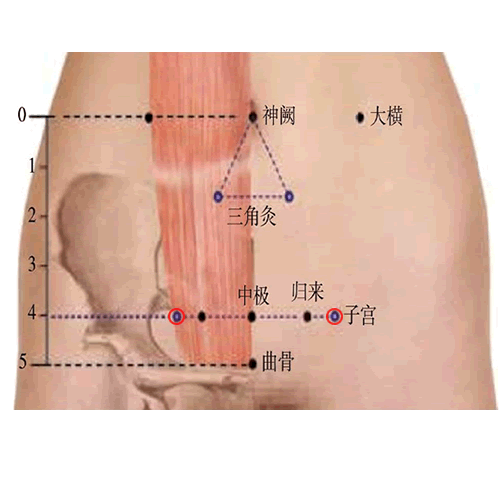 子宫
