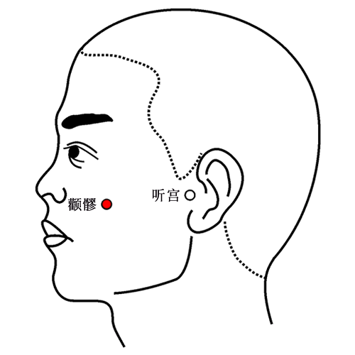 颧髎