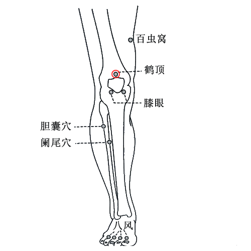 鹤顶