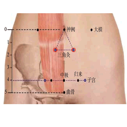 三角灸