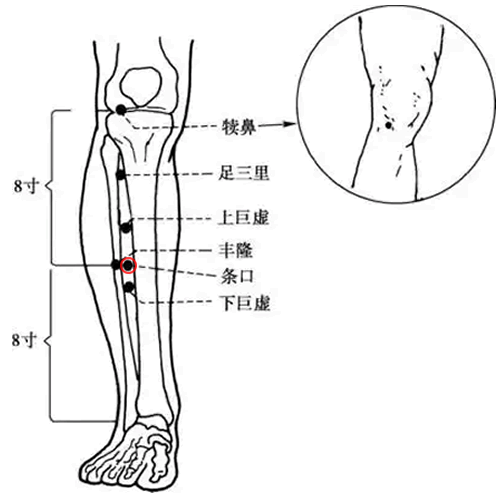 条口