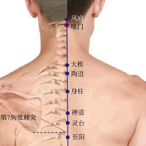 哑门
