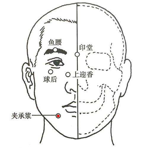 夹承浆